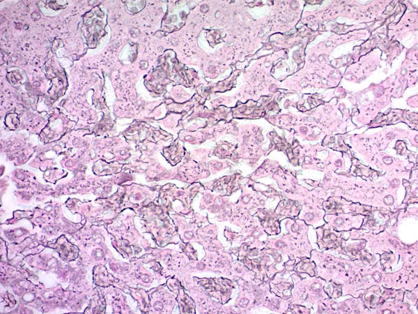 Immunohistochemistry (Formalin/PFA-fixed paraffin-embedded sections) - Reticulum Stain Kit (Modified Gomori's) (AB236473)
