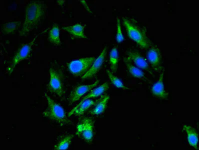 Immunocytochemistry/ Immunofluorescence - Anti-Retinoblastoma binding protein 6 antibody (AB237514)