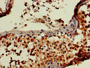 Immunohistochemistry (Formalin/PFA-fixed paraffin-embedded sections) - Anti-Retinoblastoma binding protein 6 antibody (AB237514)