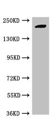 Western blot - Anti-Retinoblastoma binding protein 6 antibody (AB237514)