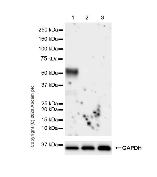 Western blot - Anti-Retinoic Acid Receptor alpha antibody [EPR23871-271] (AB275745)