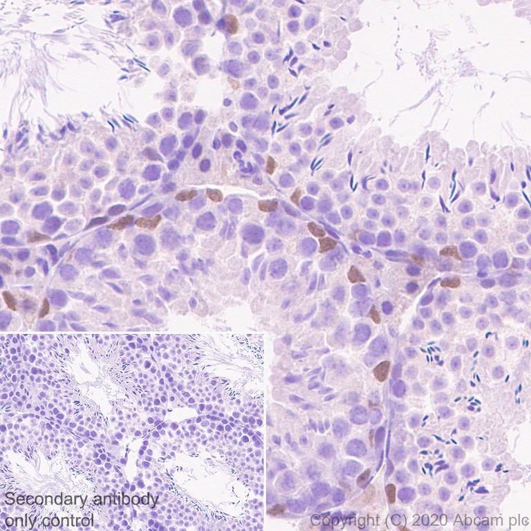 Immunohistochemistry (Formalin/PFA-fixed paraffin-embedded sections) - Anti-Retinoic Acid Receptor alpha antibody [EPR23871-271] - BSA and Azide free (AB275748)