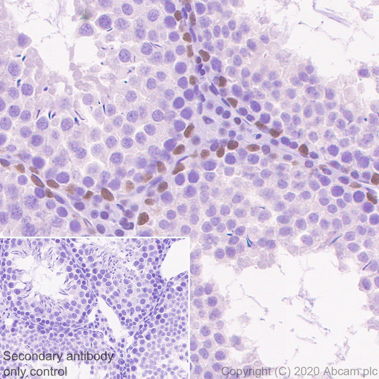 Immunohistochemistry (Formalin/PFA-fixed paraffin-embedded sections) - Anti-Retinoic Acid Receptor alpha antibody [EPR23871-271] - BSA and Azide free (AB275748)
