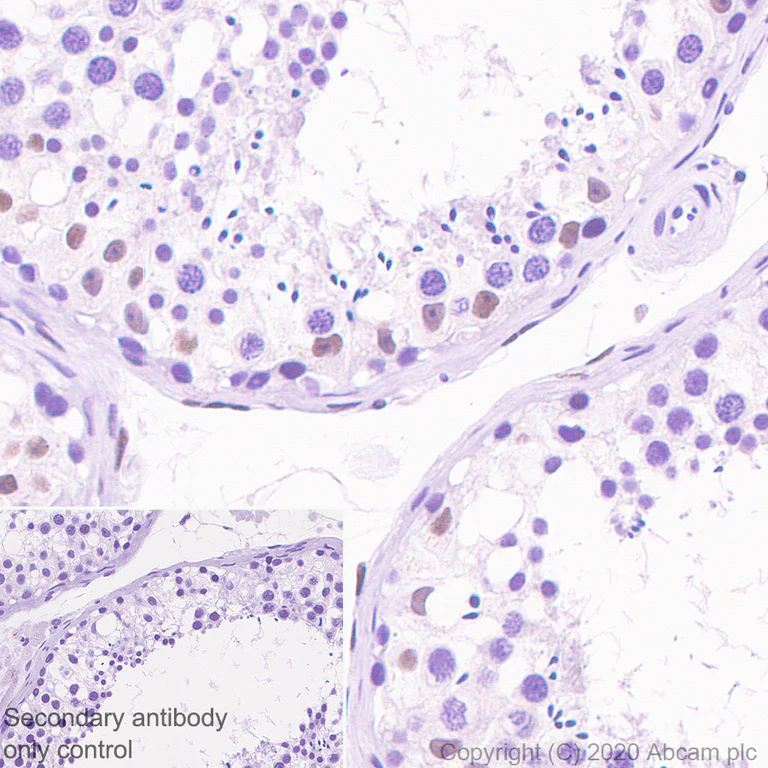 Immunohistochemistry (Formalin/PFA-fixed paraffin-embedded sections) - Anti-Retinoic Acid Receptor alpha antibody [EPR23871-271] - BSA and Azide free (AB275748)