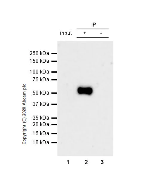 Immunoprecipitation - Anti-Retinoic Acid Receptor alpha antibody [EPR23871-271] - BSA and Azide free (AB275748)