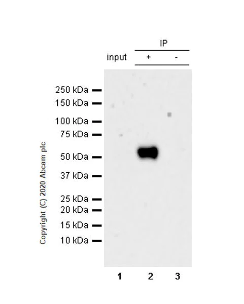 Immunoprecipitation - Anti-Retinoic Acid Receptor alpha antibody [EPR23871-271] - BSA and Azide free (AB275748)