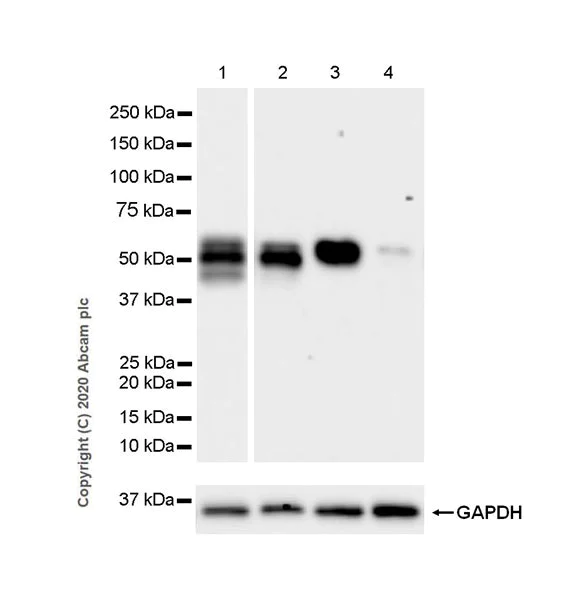 Western blot - Anti-Retinoic Acid Receptor alpha antibody [EPR23871-271] - BSA and Azide free (AB275748)