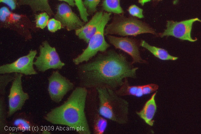 Immunocytochemistry/ Immunofluorescence - Anti-Retinoic Acid Receptor beta antibody (AB53161)