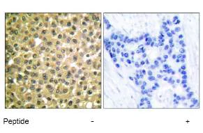 Immunohistochemistry (Formalin/PFA-fixed paraffin-embedded sections) - Anti-Retinoic Acid Receptor beta antibody (AB53161)