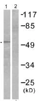 Western blot - Anti-Retinoic Acid Receptor beta antibody (AB53161)