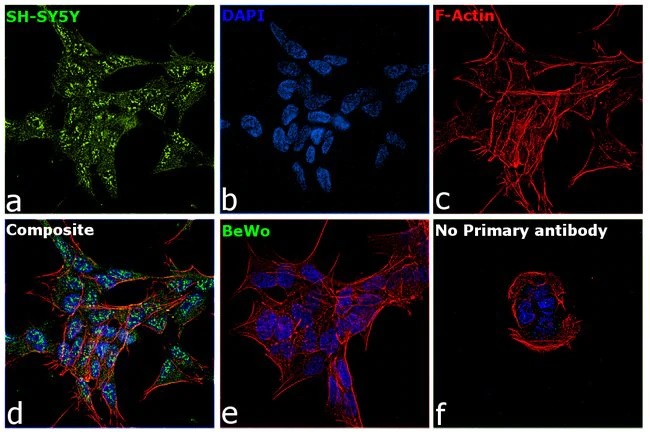 Immunocytochemistry/ Immunofluorescence - Anti-Retinoic Acid Receptor beta antibody (AB5792)