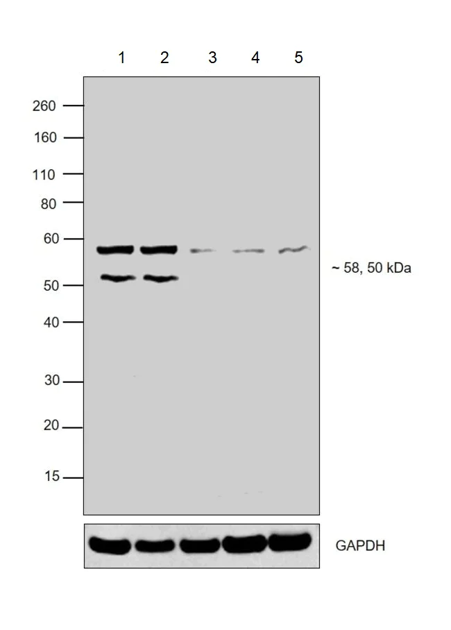 Western blot - Anti-Retinoic Acid Receptor beta antibody (AB5792)
