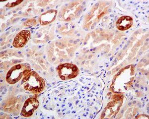 Immunohistochemistry (Formalin/PFA-fixed paraffin-embedded sections) - Anti-Retinoic Acid Receptor beta antibody [EPR2017] (AB124701)