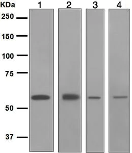 Western blot - Anti-Retinoic Acid Receptor beta antibody [EPR2017] (AB124701)