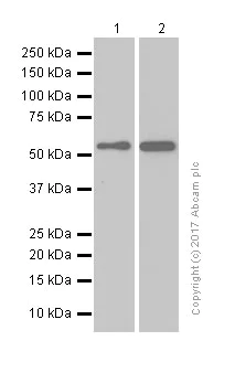 Western blot - Anti-Retinoic Acid Receptor beta antibody [EPR2017] (AB124701)