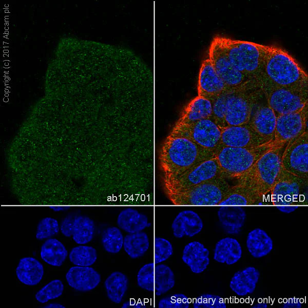 Immunocytochemistry/ Immunofluorescence - Anti-Retinoic Acid Receptor beta antibody [EPR2017] - BSA and Azide free (AB247968)