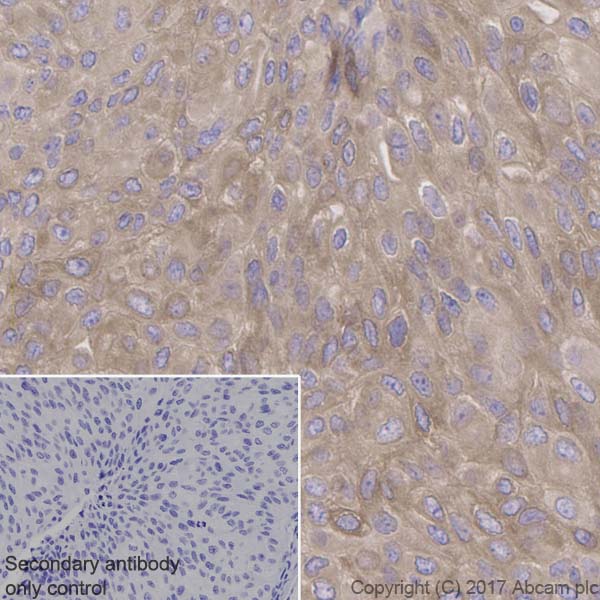 Immunohistochemistry (Formalin/PFA-fixed paraffin-embedded sections) - Anti-Retinoic Acid Receptor beta antibody [EPR2017] - BSA and Azide free (AB247968), expandable thumbnail