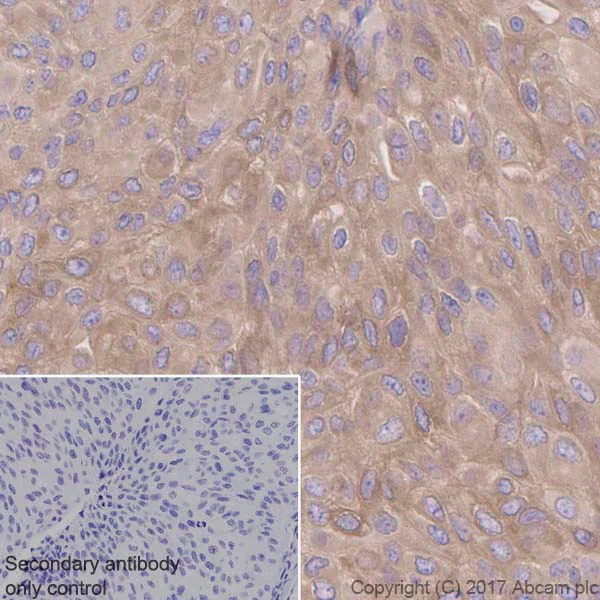 Immunohistochemistry (Formalin/PFA-fixed paraffin-embedded sections) - Anti-Retinoic Acid Receptor beta antibody [EPR2017] - BSA and Azide free (AB247968)