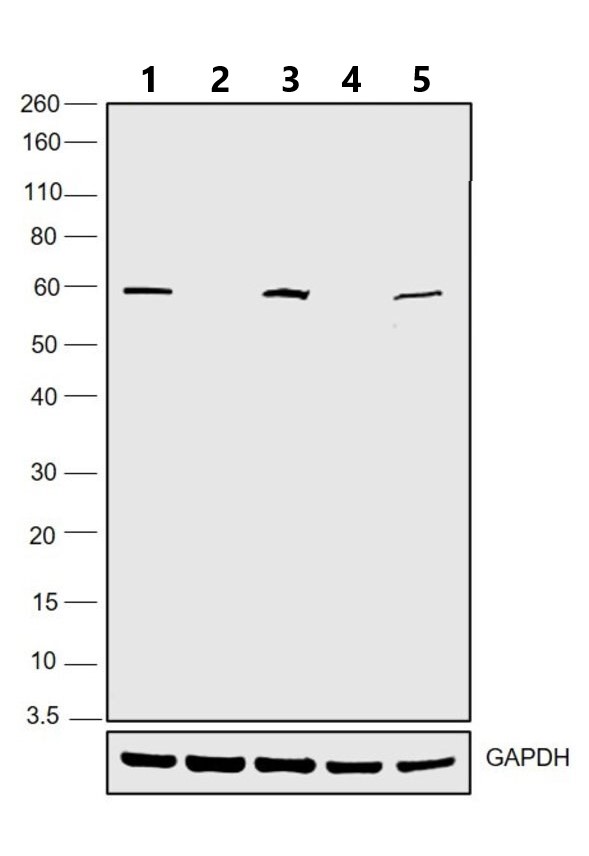 Western blot - Anti-Retinoic Acid Receptor gamma 1 antibody (AB5904), expandable thumbnail