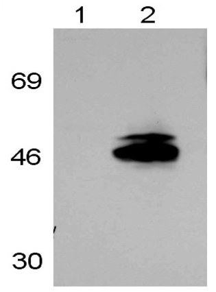 Western blot - Anti-Retinoic Acid Receptor gamma 1 antibody (AB5904), expandable thumbnail
