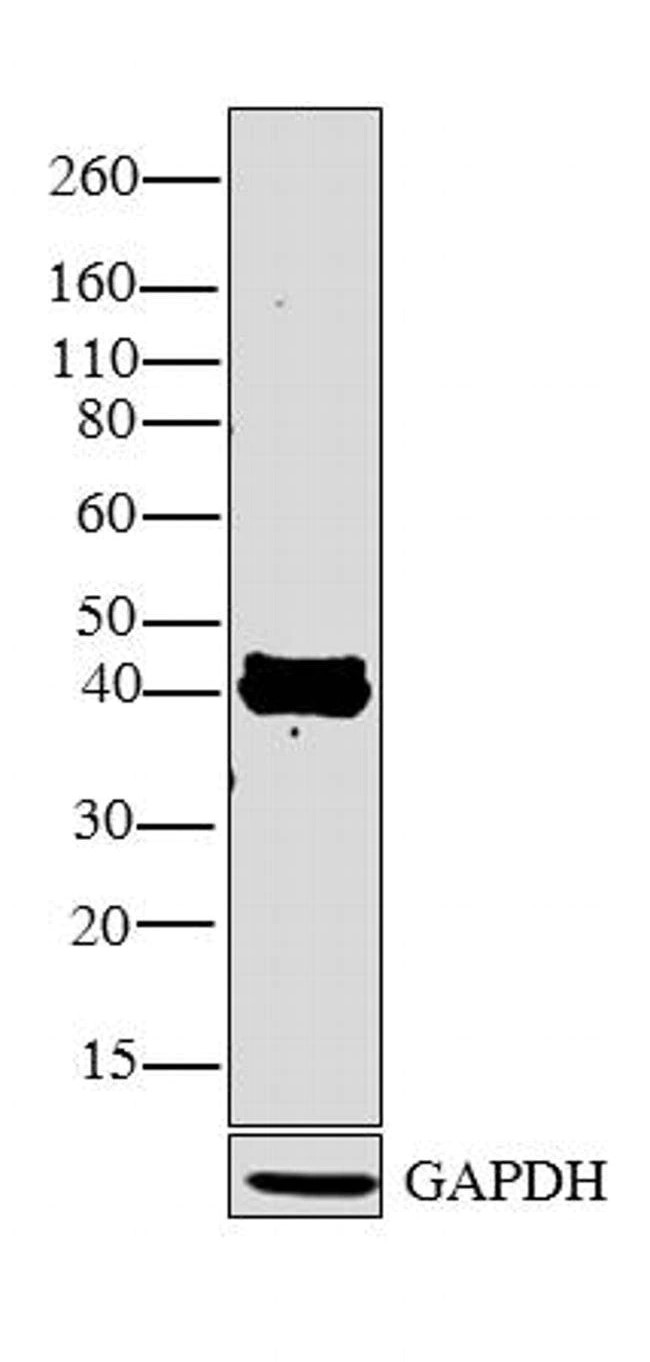 Western blot - Anti-Retinoic Acid Receptor gamma 1 antibody (AB5904), expandable thumbnail