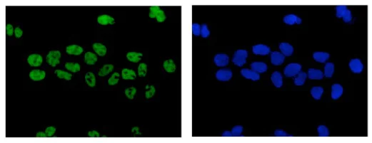 Immunocytochemistry/ Immunofluorescence - Anti-Retinoic Acid Receptor gamma antibody [EPR2020(N)] - N-terminal (AB187159)