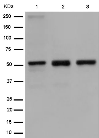 Western blot - Anti-Retinoic Acid Receptor gamma antibody [EPR2020(N)] - N-terminal (AB187159)