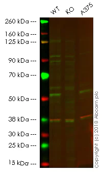 Western blot - Anti-Retinoic Acid Receptor gamma antibody [EPR2020(N)] - N-terminal (AB187159)