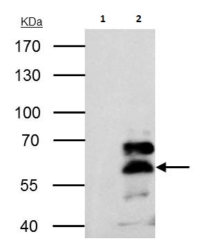 Immunoprecipitation - Anti-Retinoid X Receptor alpha/RXRA antibody (AB227273)