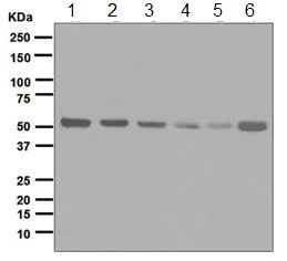 Western blot - Anti-Retinoid X Receptor alpha/RXRA antibody [EPR7106] (AB125001)