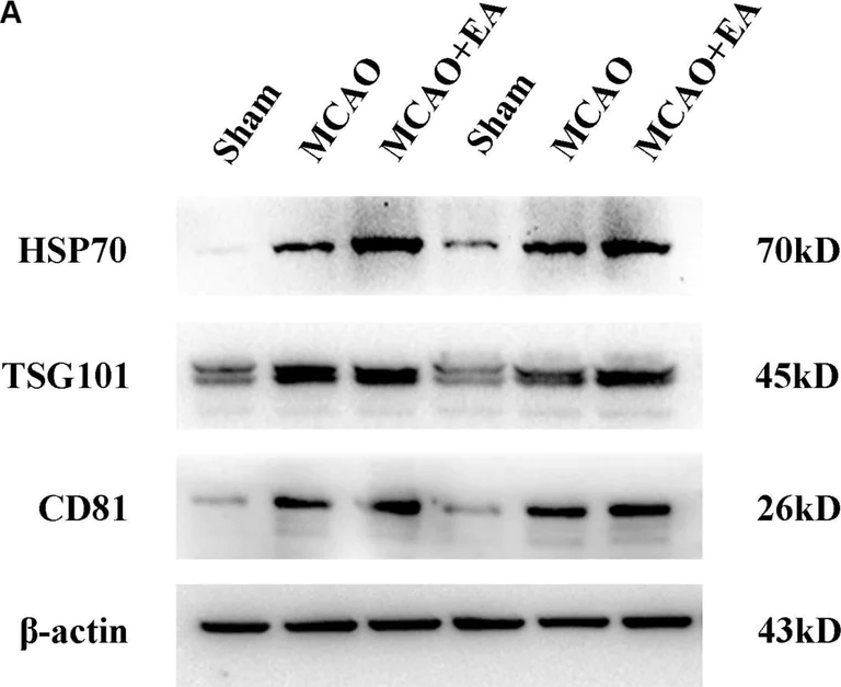 Western blot - Anti-Retinoid X Receptor alpha/RXRA antibody [EPR7106] (AB125001)