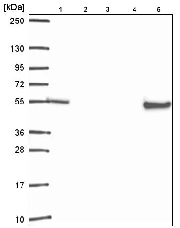 Western blot - Anti-Retinoid X Receptor beta/RXRB antibody (AB221115)