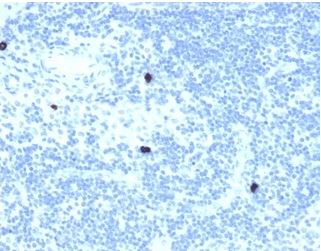 Immunohistochemistry (Formalin/PFA-fixed paraffin-embedded sections) - Anti-Retinoid X Receptor beta/RXRB antibody [PCRP-RXRB-2B6] (AB277104), expandable thumbnail