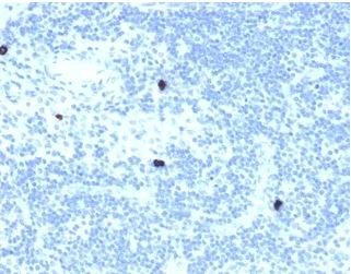 Immunohistochemistry (Formalin/PFA-fixed paraffin-embedded sections) - Anti-Retinoid X Receptor beta/RXRB antibody [PCRP-RXRB-2B6] (AB277104)