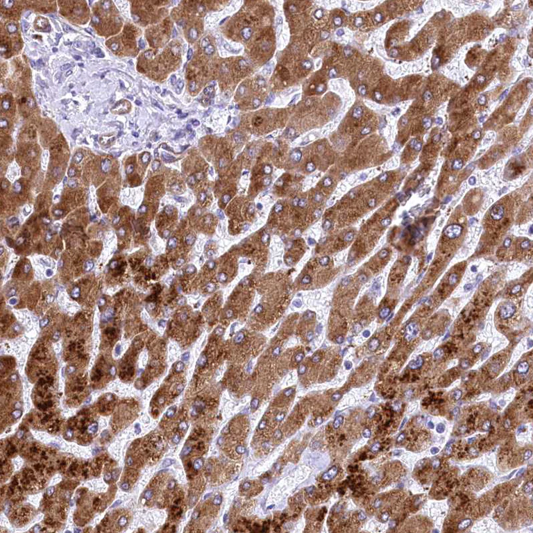Immunohistochemistry (Formalin/PFA-fixed paraffin-embedded sections) - Anti-Retinol dehydrogenase 16 antibody (AB224163)