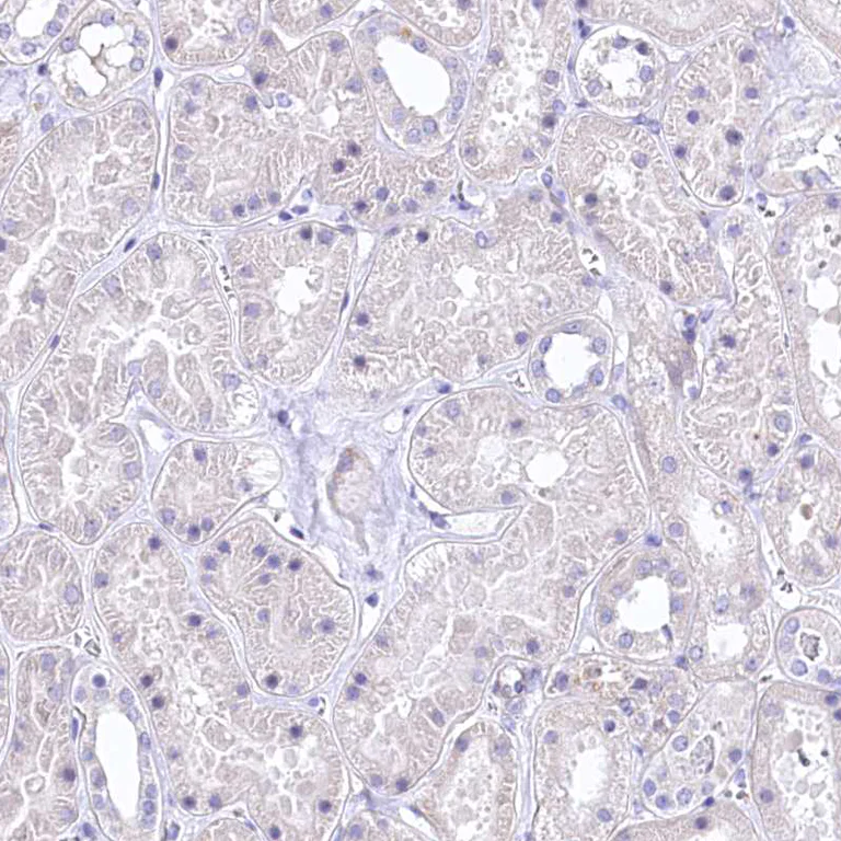 Immunohistochemistry (Formalin/PFA-fixed paraffin-embedded sections) - Anti-Retinol dehydrogenase 16 antibody (AB224163)