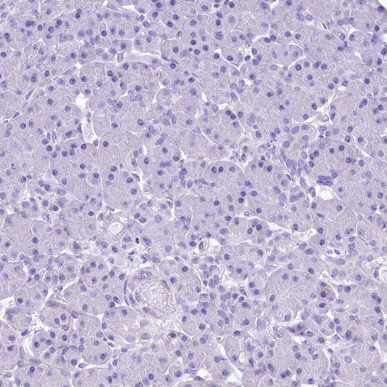 Immunohistochemistry (Formalin/PFA-fixed paraffin-embedded sections) - Anti-Retinol dehydrogenase 16 antibody (AB224163)