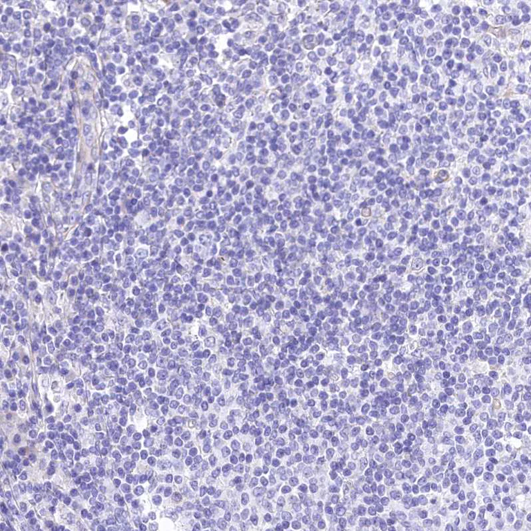 Immunohistochemistry (Formalin/PFA-fixed paraffin-embedded sections) - Anti-Retinol dehydrogenase 16 antibody (AB224163)