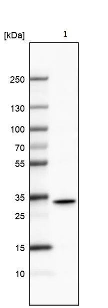 Western blot - Anti-Retinol dehydrogenase 16 antibody (AB224163)