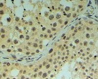 Immunohistochemistry (Formalin/PFA-fixed paraffin-embedded sections) - Anti-REV1 antibody (AB5088)