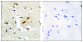 Immunohistochemistry (Formalin/PFA-fixed paraffin-embedded sections) - Anti-REV3L antibody (AB111729)