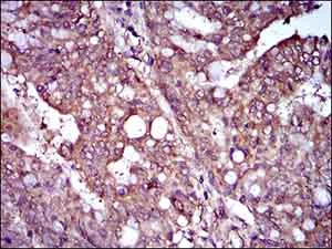 Immunohistochemistry (Formalin/PFA-fixed paraffin-embedded sections) - Anti-Rex1 antibody [5E11E7] (AB175431)