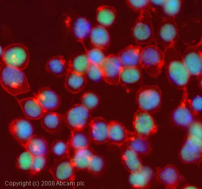 Immunocytochemistry/ Immunofluorescence - Anti-Rex1 antibody (AB28141)