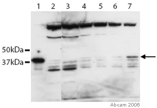 Western blot - Anti-Rex1 antibody (AB28141)