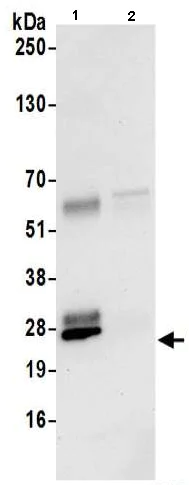 Immunoprecipitation - Anti-REXO2 antibody (AB206694)