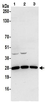 Western blot - Anti-REXO2 antibody (AB206694)