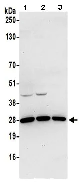 Western blot - Anti-REXO2 antibody (AB206694)