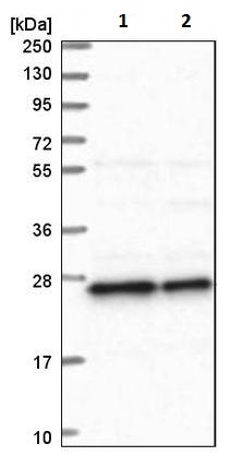 Western blot - Anti-REXO2 antibody (AB224547)