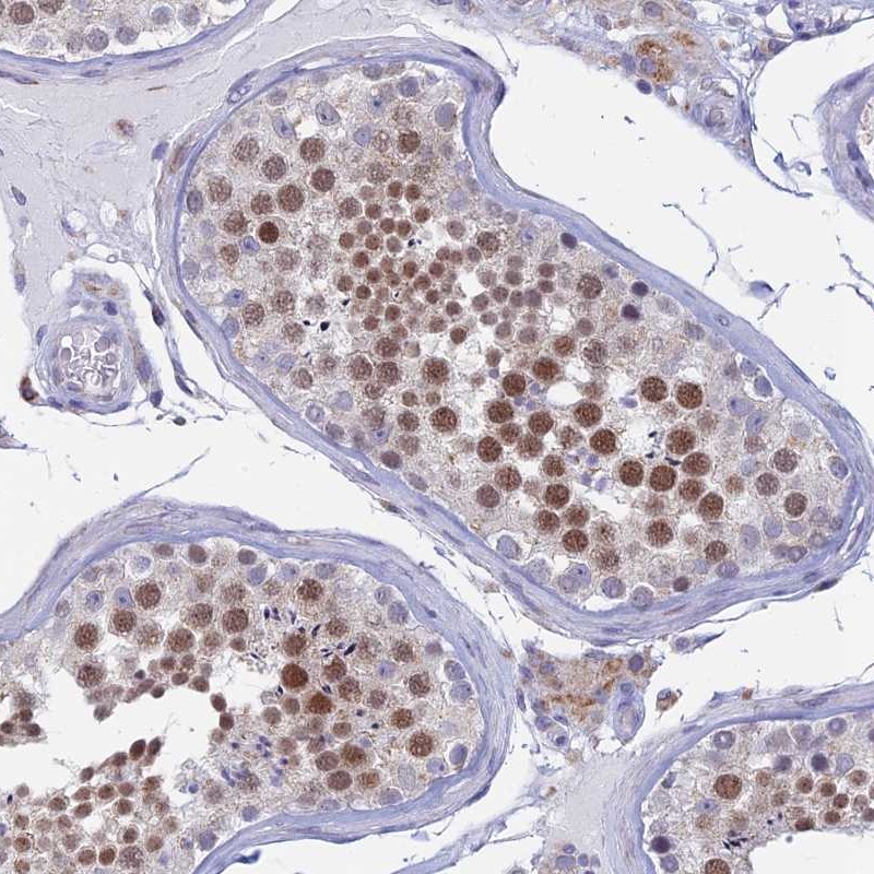Immunohistochemistry (Formalin/PFA-fixed paraffin-embedded sections) - Anti-REXO5 antibody (AB247021)