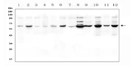 Western blot - Anti-RFC antibody (AB272354)